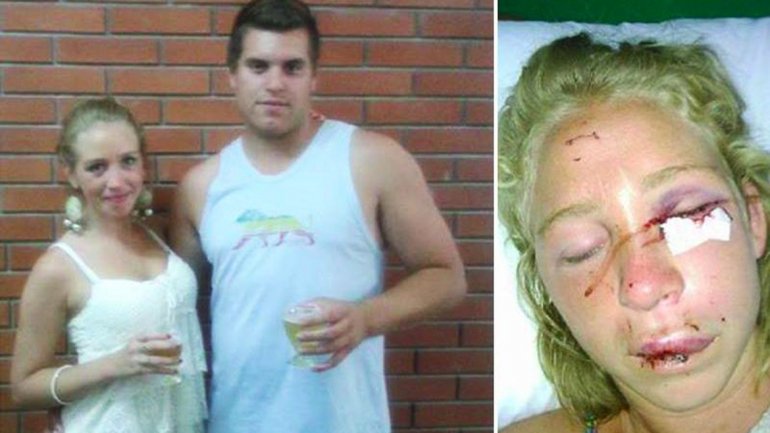 MUJER GOLPEADA EN MDP